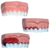 Macro Modelo Evolução da Doença Periodontal