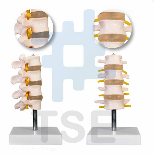 LXT PANDA Modelo de demostración de la Columna Lumbar Humana con Hernia  DIS, Modelo anatómico Vértebras lumbares Sacro y cóccix para Ciencias  Estudio en el Aula Enseñanza de exhibición. : : Industria