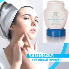 Gel Secante de Espinhas e Cravos ACNEW Abelha Rainha 55g REF 3053 - comprar online