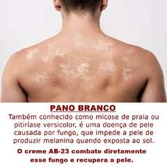 Creme Contra Pano Branco Micose de Praia Pitiríase Versicolor AB 23 MIXDERME Abelha Rainha 55gr REF 2063 - Importados da Malu