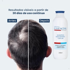 Shampoo de Crescimento Capilar 250ml Essencial For Men Abelha Rainha REF 7645 - Importados da Malu