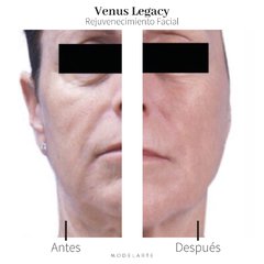 Venus Legacy · 1 Zona en internet