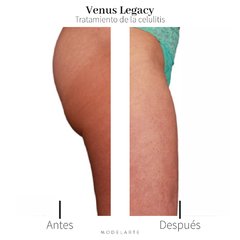 Venus Legacy · 2 zonas - comprar online