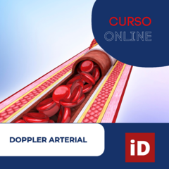 Doppler Arterial con ImagingXpert