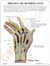 Mão para Artrite Reumatóide (AR) - comprar online