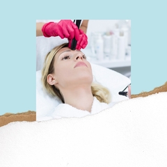 Radiofrecuencia Tripolar Facial con láser frio