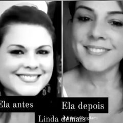 Antes e Depois