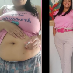 Antes e Depois