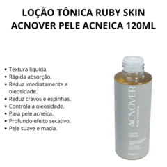 Loção Tônica Antiacne ACNOVER - Ruby Rose - comprar online