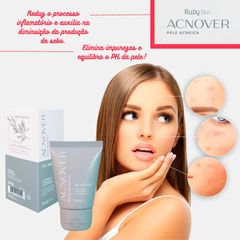 Gel Antiacne Acnover - Hb424 - Ruby Rose - comprar online