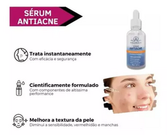 Kit Tratamento Completo Antiacne E Cravos Phállebeauty - Portal Make