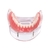 Modelo para dentaduras e próteses dentárias, dispositivo removível de uso interno para ensino de dentes com implante na internet