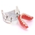 Modelo para dentaduras e próteses dentárias, dispositivo removível de uso interno para ensino de dentes com implante