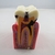 Modelo de Dentes Modelo de Comparação de Cárie Modelo de Cárie - PRODUTO IMPORTADO - comprar online