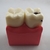 Modelo de Dentes Modelo de Comparação de Cárie Modelo de Cárie - PRODUTO IMPORTADO na internet