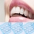 Piercing dental / Quantidade 10 - PRODUTO IMPORTADO