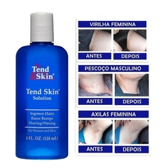 Tend Skin 118ml - Loção Para Pelos Encravados E Foliculite na internet