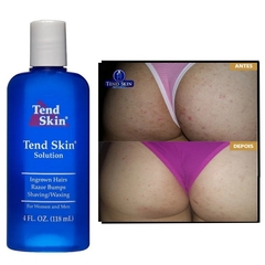 Tend Skin 118ml - Loção Para Pelos Encravados E Foliculite - comprar online