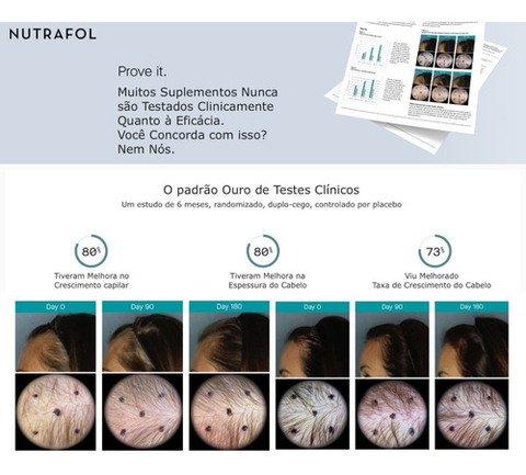 Nutrafol Women Suplemento Capilar | Clinicamente comprovado | 100% Natural | Mulheres de Todas as Idades(+18 anos) e Estágios | Kit3 | 360 Cápsulas | Tratamento de 3 Meses - comprar online