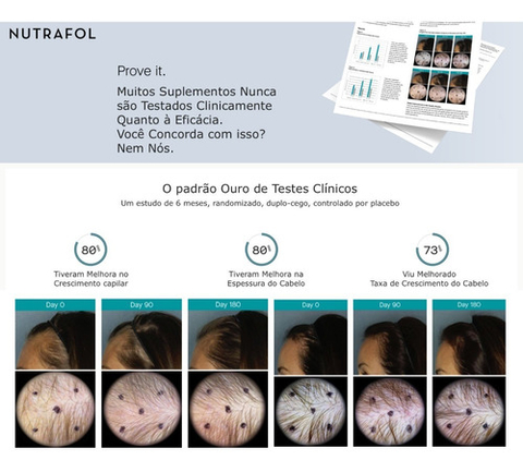 Nutrafol Women Suplemento Capilar | Clinicamente comprovado | 100% Natural | Mulheres de Todas as Idades(+18 anos) e Estágios | 120 Cápsulas | Tratamento de 1 Mês - comprar online