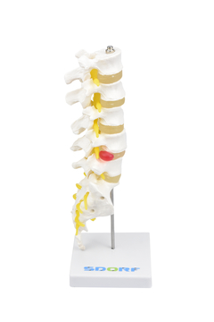 Coluna Lombar SD-5012 - Mix Anatomy - Simuladores e Modelos Anatômicos