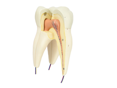 Dente Molar Superior c/ Raiz Tripla em 3 Partes, 8x o Tamanho Real Aprox. SD-5059/F - comprar online