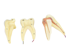 Dente Molar Superior c/ Raiz Tripla em 3 Partes, 8x o Tamanho Real Aprox. SD-5059/F - Mix Anatomy - Simuladores e Modelos Anatômicos