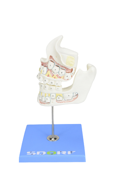 Desenvolvimento da Dentição em 4 Etapas SD-5059/G na internet