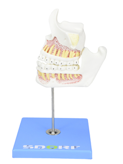 Desenvolvimento da Dentição em 4 Etapas SD-5059/G - Mix Anatomy - Simuladores e Modelos Anatômicos