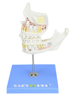 Desenvolvimento da Dentição em 4 Etapas SD-5059/G - loja online