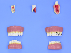 Modelo de Patologias Dentárias c/ 12 Partes em Placa SD-5059/L na internet