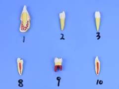 Modelo de Patologias Dentárias c/ 25 Partes em Placa SD-5059/M - comprar online