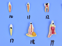 Modelo de Patologias Dentárias c/ 25 Partes em Placa SD-5059/M na internet