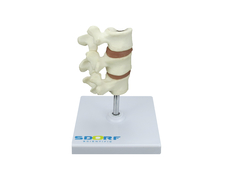 Modelo de Osteoporose SD-5200 - comprar online