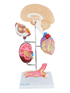 Modelo de Órgãos afetados pela Hipertensão em 8 partes SD-5212