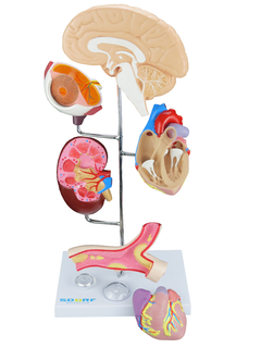 Modelo de Órgãos afetados pela Hipertensão em 8 partes SD-5212 - comprar online
