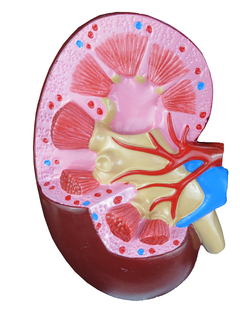 Modelo de Órgãos afetados pela Hipertensão em 8 partes SD-5212 - Mix Anatomy - Simuladores e Modelos Anatômicos