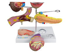 Modelo de Órgãos Afetados pela Diabetes em 11 partes SD-5213 na internet