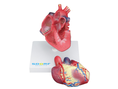 Modelo Patológico do Coração com Hipertrofia em 2 Partes SD-5214 - Mix Anatomy - Simuladores e Modelos Anatômicos