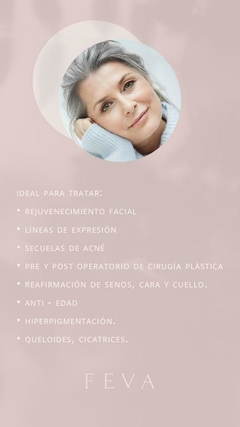 MESOTERAPIA VIRTUAL FACIAL en internet