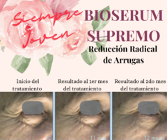 BioSerum Supremo 40+ Reducción Radical de Arrugas en internet