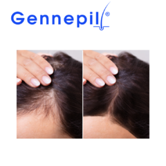 Gennepil Shampoo Tratamiento Anticaida en internet