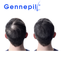 Gennepil Shampoo Tratamiento Anticaida - Biogenné