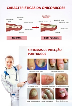 Essência herbal antifúngica à base de extratos de flores e de raízes