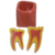 Macro Modelo Anatômico Odontológico - Dente Molar - Prevenção Express