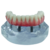 Macro Modelo Anatômico Odontológico Mandíbula com Protocolo Branemark de 4 Implantes