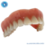 Macro Modelo Anatômico Odontológico Overdenture em Acrílico com 4 implantes Barra Clip na internet