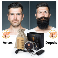 Kit para Crescimento de Barba (SKINER) – 100% Puro e Natural - comprar online