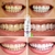 RtopR Dentes Limpa Manchas Remove o Hálito Refresca os Dentes Mousse de Clareamento - comprar online