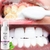 Imagem do Mousse de Clareamento Dental para Limpeza de Dentes Remove Manchas Essência de Higiene Bucal
